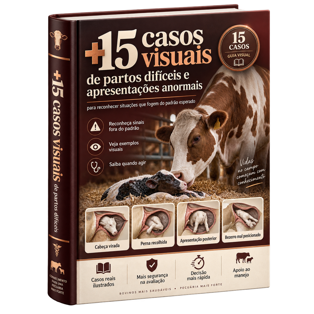 Capa do bônus 03: +15 Casos de Partos Difíceis e Apresentações Anormais